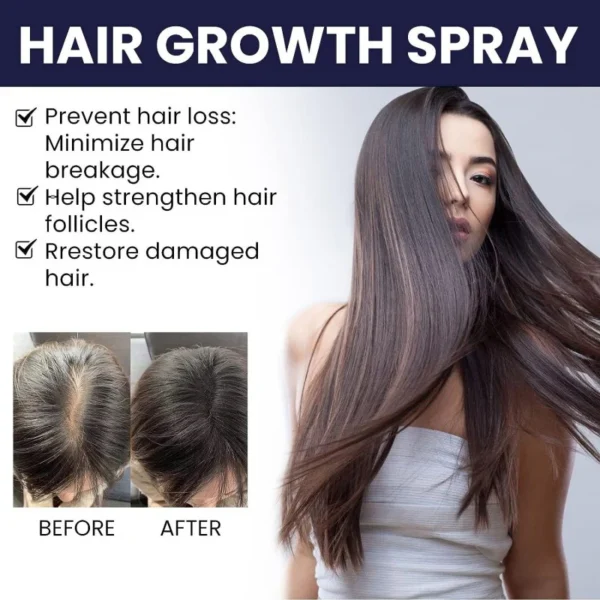 FEG Hair Growth Spray | Free Delivery - Image 2