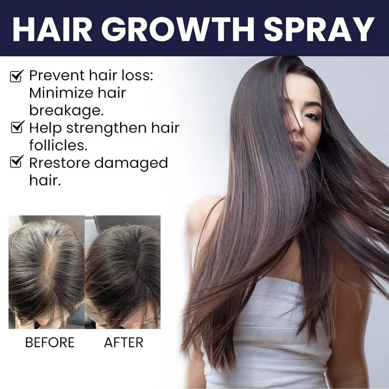 FEG Hair Growth Spray | Free Delivery